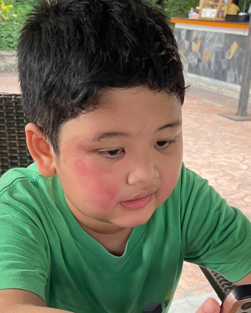 merah terbakar matahari